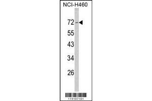 Image no. 1 for anti-Neurofibromin 2 (NF2) (AA 65-95), (N-Term) antibody (ABIN390756)