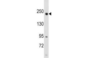 Image no. 3 for anti-RPTOR Independent Companion of mTOR, Complex 2 (RICTOR) (AA 236-267) antibody (ABIN3028994)