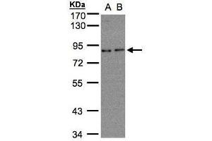 Image no. 3 for anti-Zyg-11 Related, Cell Cycle Regulator (ZER1) (C-Term) antibody (ABIN2856467)