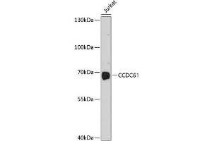 Western blot analysis of extracts of Jurkat cells using CCDC61 Polyclonal Antibody at dilution of 1:1000.