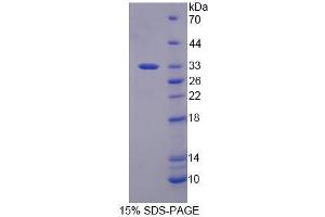 Image no. 1 for Replication Factor C (Activator 1) 2, 40kDa (RFC2) (AA 53-327) protein (His tag) (ABIN6239667)