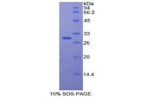 Image no. 1 for Catenin (Cadherin-Associated Protein), beta 1, 88kDa (CTNNB1) protein (ABIN3008696)