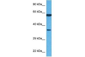 Image no. 3 for anti-Prolyl 4-Hydroxylase, beta Polypeptide (P4HB) (N-Term) antibody (ABIN2783245)