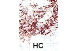 Image no. 2 for anti-Histone Deacetylase 11 (HDAC11) (AA 1-30), (N-Term) antibody (ABIN387964)