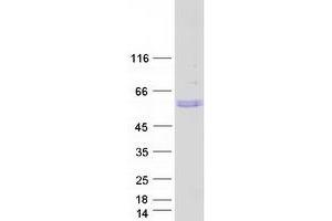 Image no. 1 for STEAP Family Member 3, Metalloreductase (STEAP3) (Transcript Variant 3) protein (Myc-DYKDDDDK Tag) (ABIN2732840)