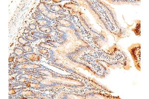 Image no. 11 for anti-Jun Proto-Oncogene (JUN) (pSer243) antibody (ABIN6255121)