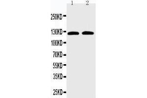Image no. 1 for anti-Solute Carrier Family 12 (Potassium-Chloride Transporter) Member 6 (SLC12A6) (AA 1060-1080), (C-Term) antibody (ABIN3042855)
