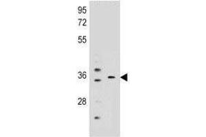 Image no. 2 for anti-Potassium Channel Regulator (KCNRG) (AA 175-202) antibody (ABIN3032276)