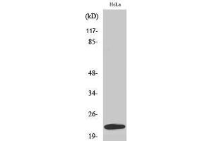 Image no. 1 for anti-Ubiquitin-Conjugating Enzyme E2T (Ube2t) (Internal Region) antibody (ABIN3187397)