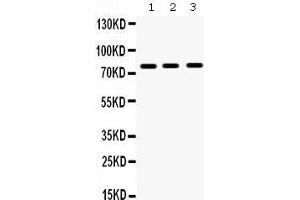 Image no. 1 for anti-Matrix Metallopeptidase 9 (Gelatinase B, 92kDa Gelatinase, 92kDa Type IV Collagenase) (MMP9) (AA 641-672), (C-Term) antibody (ABIN3043884)