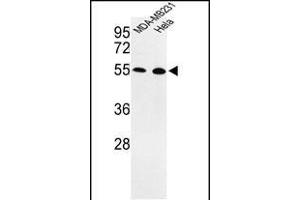 PHD1 Antikörper  (AA 194-221)