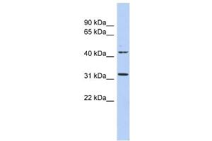 Image no. 1 for anti-Methyltransferase Like 6 (METTL6) (N-Term) antibody (ABIN631546)