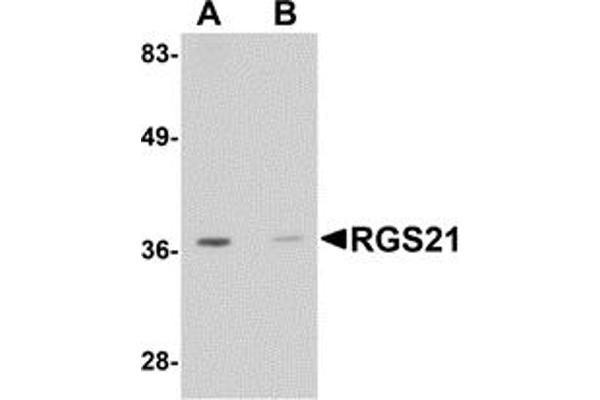 RGS21 antibody  (Middle Region)