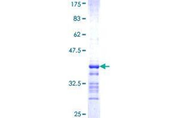 SEPHS2 Protein (AA 61-150) (GST tag)