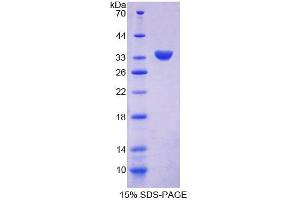 Image no. 1 for Chimerin (Chimaerin) 2 (CHN2) (AA 1-264) protein (His tag) (ABIN6239085)