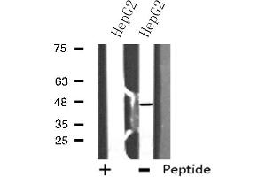 Image no. 1 for anti-E2F Transcription Factor 2 (E2F2) (Internal Region) antibody (ABIN6257150)
