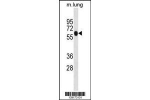 Western Blotting (WB) image for anti-Enolase Family Member 4 (ENO4) (Center) antibody (ABIN2160914)