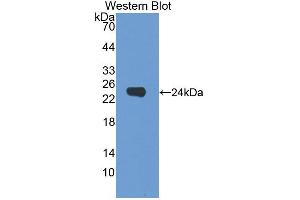 Image no. 2 for anti-Dermokine (DMKN) (AA 27-238) antibody (ABIN1867596)