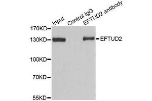 Image no. 7 for anti-Elongation Factor Tu GTP Binding Domain Containing 2 (EFTUD2) antibody (ABIN6139968)