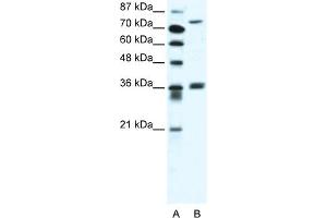 Image no. 1 for anti-Midline 1 (MID1) (C-Term) antibody (ABIN2775948)