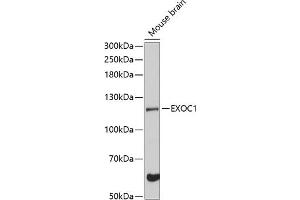 EXOC1 抗体  (AA 645-894)