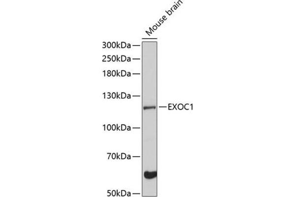 EXOC1 抗体  (AA 645-894)