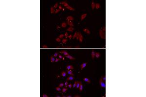 Image no. 2 for anti-Nephronophthisis 1 (Juvenile) (NPHP1) antibody (ABIN2564205)