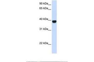 Image no. 1 for anti-Forkhead Box E1 (Thyroid Transcription Factor 2) (FOXE1) (AA 254-303) antibody (ABIN6737656)
