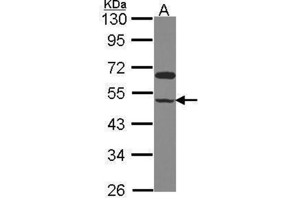 anti-Glutamate Receptor, Ionotropic, N-Methyl D-Aspartate-Like 1A (GRINL1A) (C-Term) antibody
