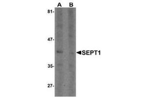 Image no. 2 for anti-Septin 1 (SEPT1) (C-Term) antibody (ABIN1449920)