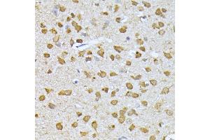 Immunohistochemistry of paraffin-embedded mouse brain using RPS27A antibody (ABIN3022728, ABIN3022729, ABIN1513489, ABIN1514633 and ABIN6219198) at dilution of 1:100 (40x lens).
