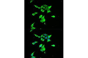 Image no. 3 for anti-Complement Decay-Accelerating Factor (CD55) antibody (ABIN3021785)