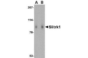 Image no. 1 for anti-SLIT and NTRK-Like Family, Member 1 (SLITRK1) (Internal Region) antibody (ABIN1493802)