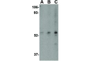 Image no. 1 for anti-SP110 Nuclear Body Protein (SP110) (C-Term) antibody (ABIN6656375)