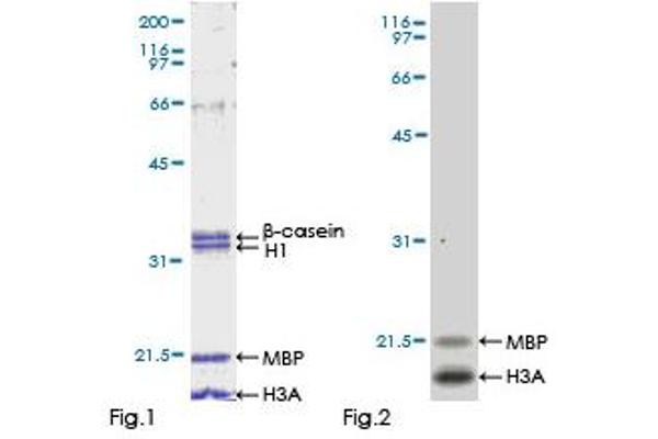 ULK4 Protein (Unc-51-Like Kinase 4) (AA 1-580) (GST tag)