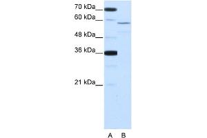 Image no. 1 for anti-Neuro-Oncological Ventral Antigen 2 (NOVA2) (Middle Region) antibody (ABIN2778800)