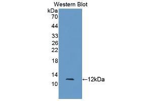 Image no. 2 for anti-S100 Calcium Binding Protein A5 (S100A5) (AA 1-93) antibody (ABIN1078506)