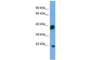 Image no. 1 for anti-Lipoyl(octanoyl) Transferase 2 (Putative) (LIPT2) (C-Term) antibody (ABIN2783689)
