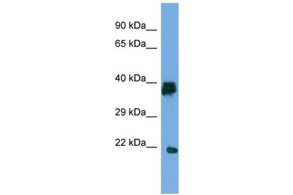 anti-Lipoyl(octanoyl) Transferase 2 (Putative) (LIPT2) (C-Term) antibody
