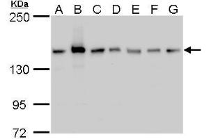 Image no. 5 for anti-rho-Associated, Coiled-Coil Containing Protein Kinase 2 (ROCK2) (Center) antibody (ABIN2855440)