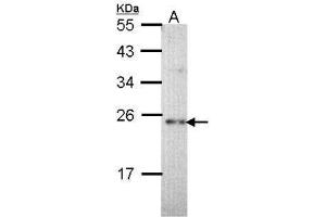 Image no. 2 for anti-Calcium Binding Protein P22 (CHP) (Internal Region) antibody (ABIN2856827)