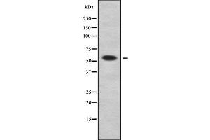 Image no. 1 for anti-Aldehyde Dehydrogenase 1 Family, Member A3 (ALDH1A3) (Internal Region) antibody (ABIN6259876)