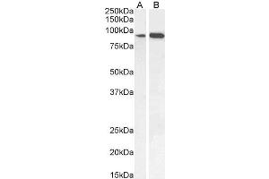 Image no. 3 for anti-Intraflagellar Transport 88 Homolog (IFT88) (C-Term) antibody (ABIN185555)
