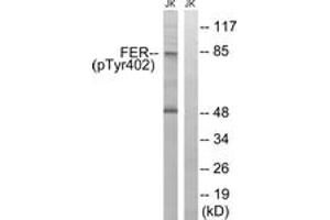 Image no. 1 for anti-FER Tyrosine Kinase (FER) (AA 371-420), (pTyr402) antibody (ABIN1532043)