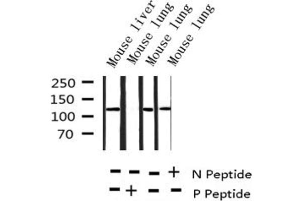 HDAC5 anticorps  (pSer498)