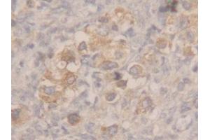 Image no. 3 for anti-Microseminoprotein, beta (MSMB) (AA 19-114) antibody (ABIN1175773)