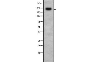 Image no. 1 for anti-K(lysine) Acetyltransferase 6B (KAT6B) antibody (ABIN6263496)