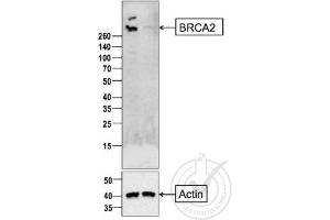 anti-Breast Cancer 2, Early Onset (BRCA2) (AA 21-130) antibody