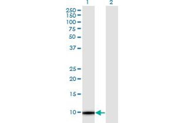 anti-Thymosin beta 4, Y-Linked (TMSB4Y) (AA 1-44) antibody