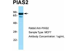 Image no. 1 for anti-Protein Inhibitor of Activated STAT, 2 (PIAS2) (C-Term) antibody (ABIN2776423)